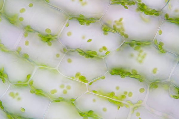 Na imagem, é possível observar a presença de estruturas verdes: os cloroplastos, organelas ricas em clorofila.