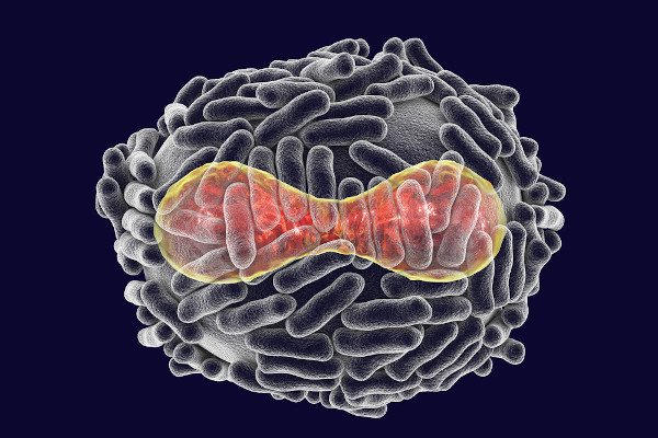 A varíola é provocada por um vírus transmitido, principalmente, por gotículas eliminadas pelo doente.