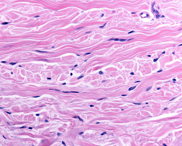 Microscopia de um tecido conjuntivo denso com fibroblastos e fibras colágenas compactadas.