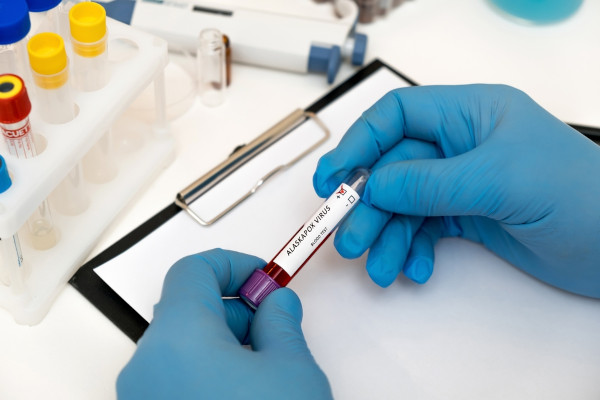 Enfermeiro segurando um exame de sangue positivo para Alaskapox, o vírus causador da varíola do Alasca.
