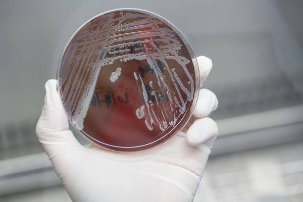 Mão segurando amostras de laboratório com análise de bactérias do reino Monera.
