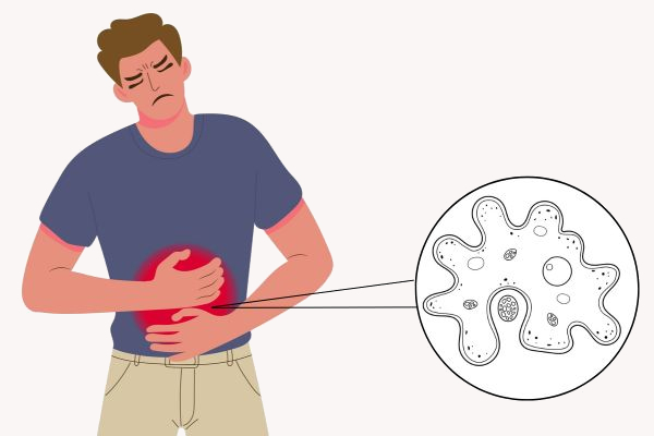 Ilustração de uma ameba ao lado de um homem com dores abdominais, sintoma de uma doença causada por protozoário. [imagem_principal]