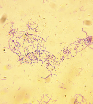 Bactéria causadora do antraz visto do microscópio