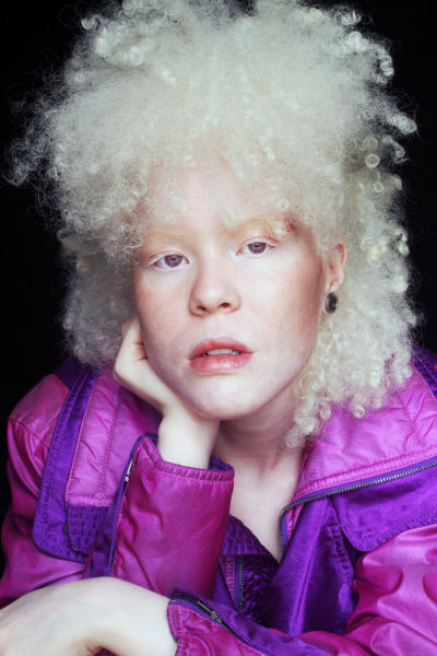 Negra, albina e com baixa visão, bolsista é aprovada em 1º lugar na USP